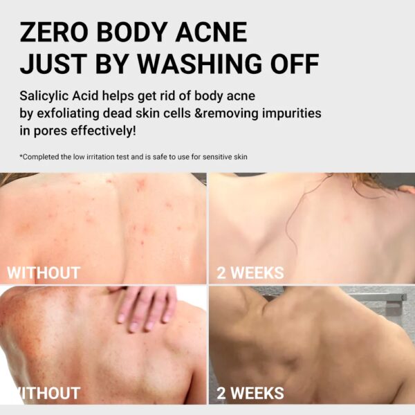 MEDICUBE Red Acne Body Wash 2.0 - Image 3