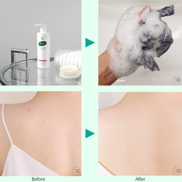 Acnes Perfect Solution Body Wash 500ml - Image 4