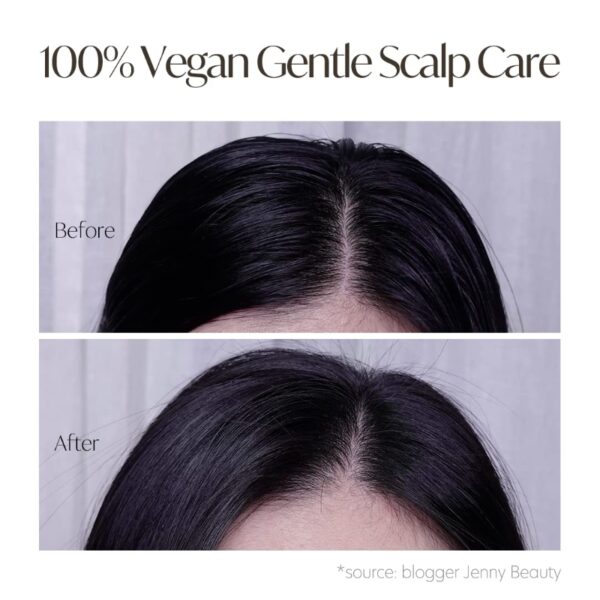 D`Alba Scalp Therapy Serum Shampoo - Image 4