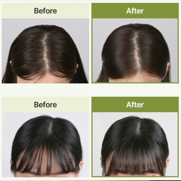 Daleaf Original Dry Shampoo - Image 5