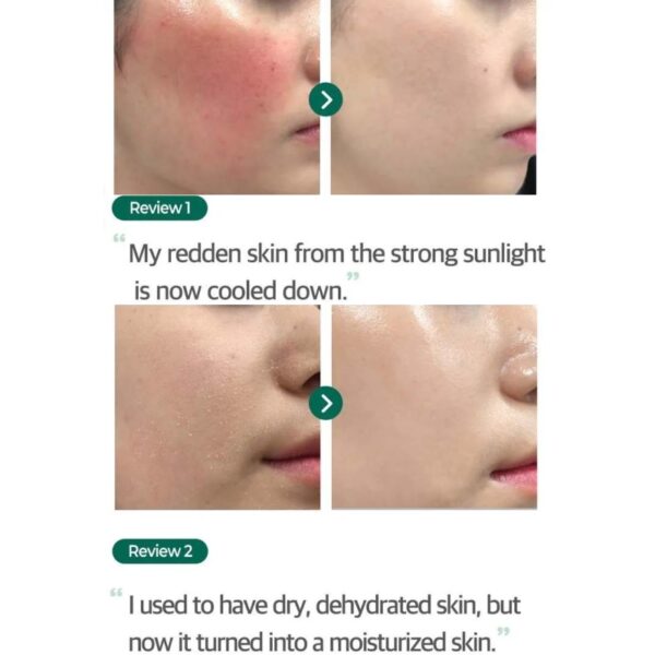 SOME BY MI AHA, BHA, PHA Real Cica 92% Cool Calming Soothing Gel 300ml - Image 5
