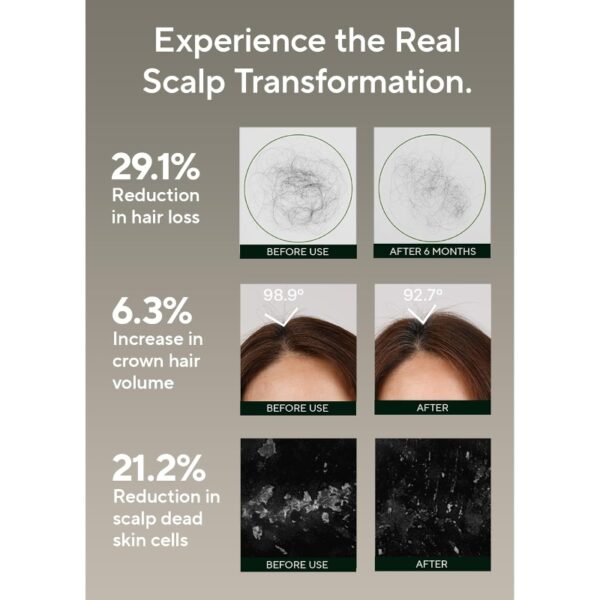 AROMATICA Rosemary Salt Scrub Shampoo Special Set (+Conditioner) - Image 4