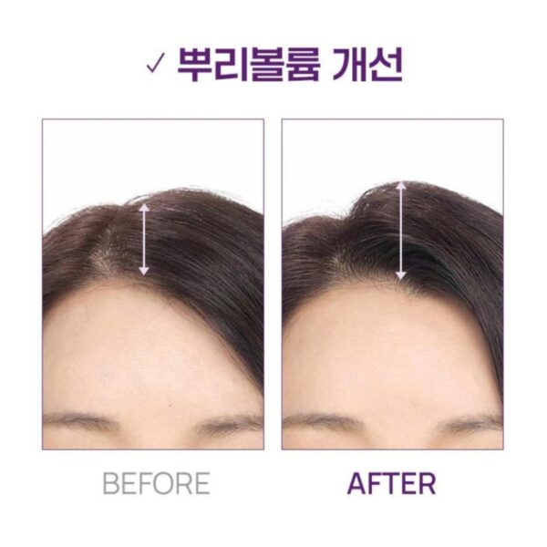 Dr. Groot Multi-Perfection Hair Loss Care Shampoo 400ml [#3 Type] (+100ml) - Image 6