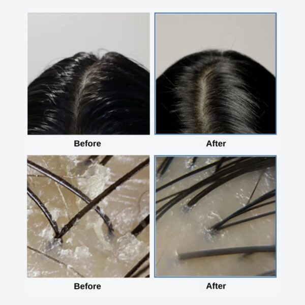 growus Sea Salt Therapy Scalp Scaler Large Volume Special Set - Image 8