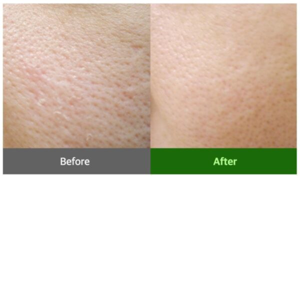 Sungboon editor Green Tomato Pore Lighting Ampoule Toner 350ml - Image 5
