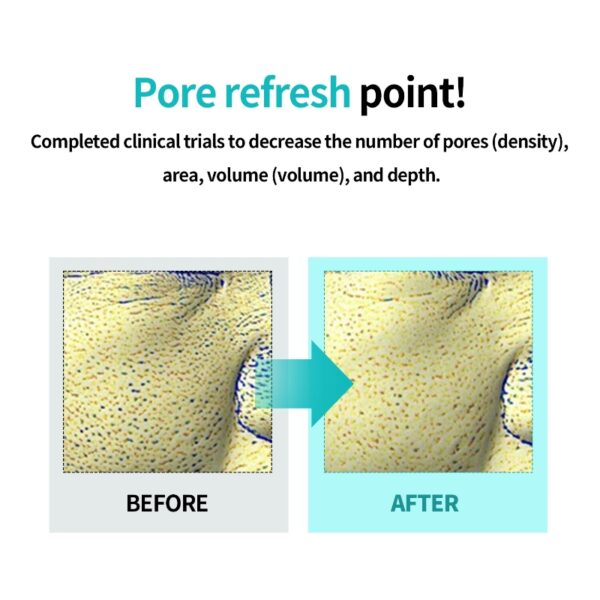 ilso Moringa Tightening Pore Serum - Image 3