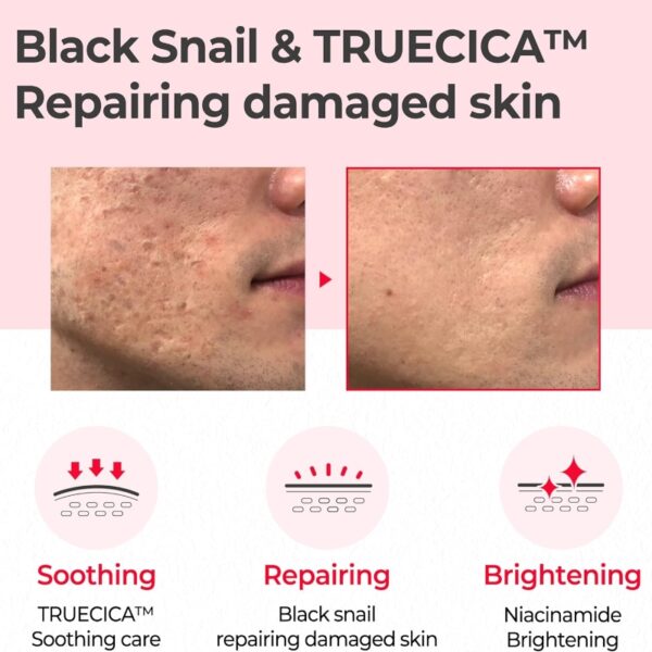 NEW💖 SOME BY MI Snail Truecica Miracle Repair Toner - Image 3