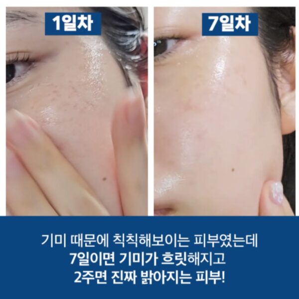 NEW💖 huecalm Niacin Vita Snow Serum - Image 5