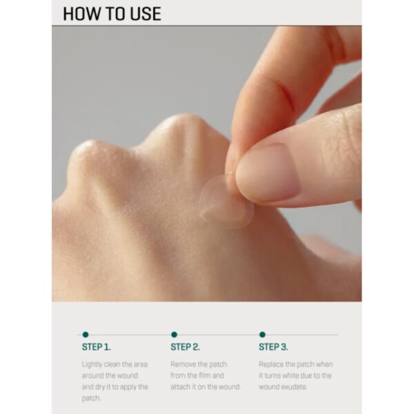 SOME BY MI 30 Days Miracle Clear Spot Patch - Image 8