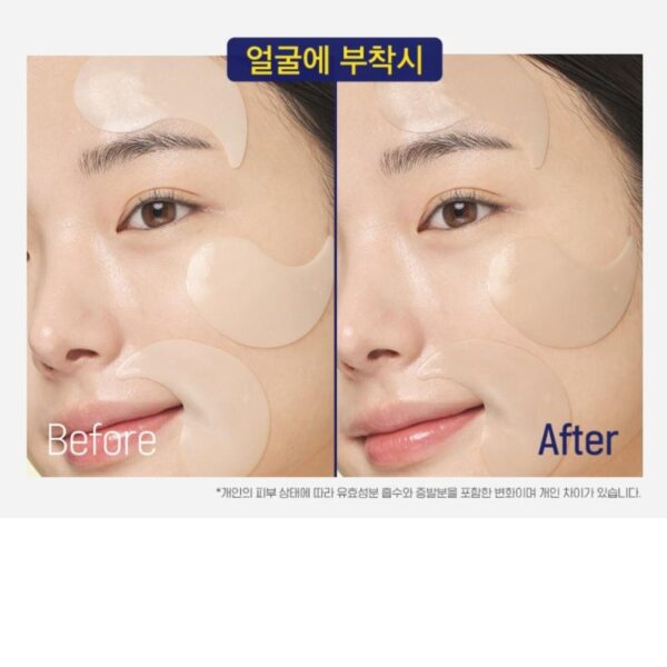 CKD Healthcare Vita C Teca Triple Blemish Patch 60P - Image 6