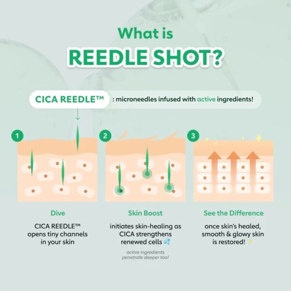 VT Pro Cica Reedle Shot S50 - Image 8