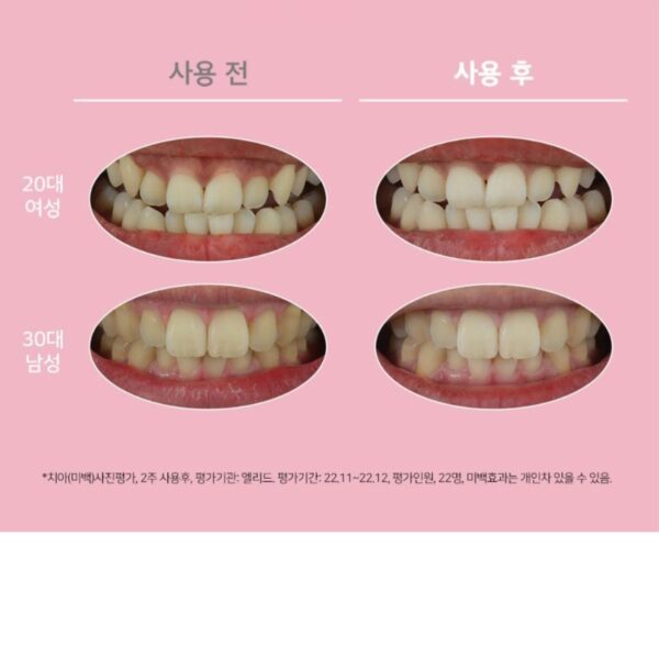 EUTHYMOL Whitening Purple Toothpaste (+Photo sticker) - Image 7