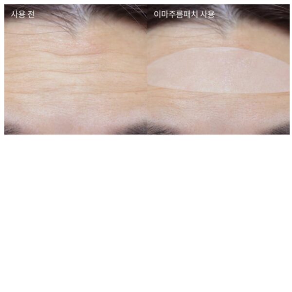 MARSHIQUE Wrinkle Repair Patch 15P - Image 5