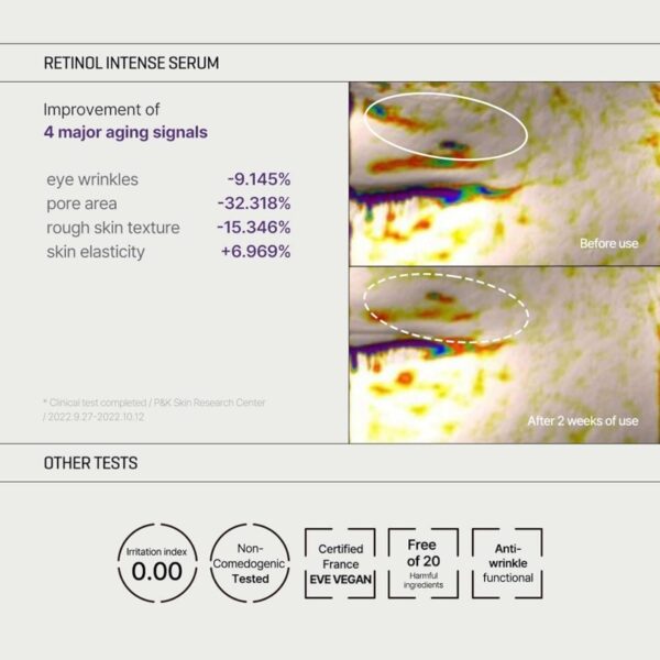 SOME BY MI Retinol Intense Trial Kit - Image 5