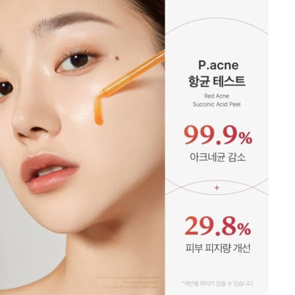 medicube Red Acne Succinc Acid Peel (+10ml) - Image 4