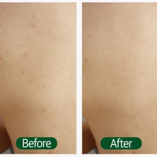 Happy Bath Deep Clean Acne Body Wash [#180g #900g] - Image 3