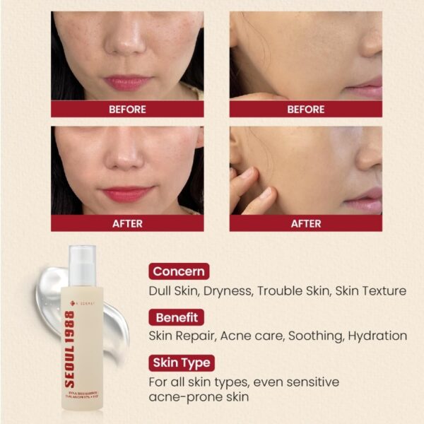 KSECRET SEOUL 1988 Essence Snail Mucin 97% + Rice 100ml - Image 3