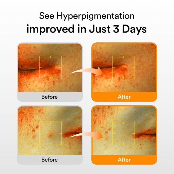 Abib Glutathiosome Dark Spot Serum Vita Drop - Image 4