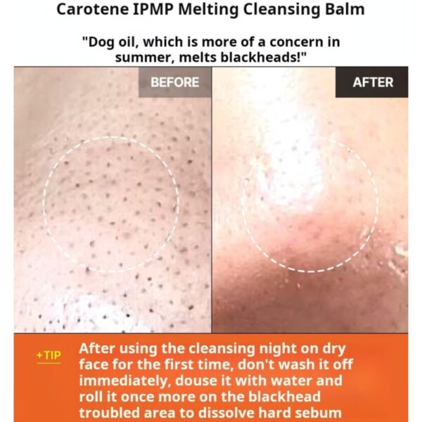 APRILSKIN Carrotene Cleansing Balm Special Set (+ Nose Brush) - Image 4