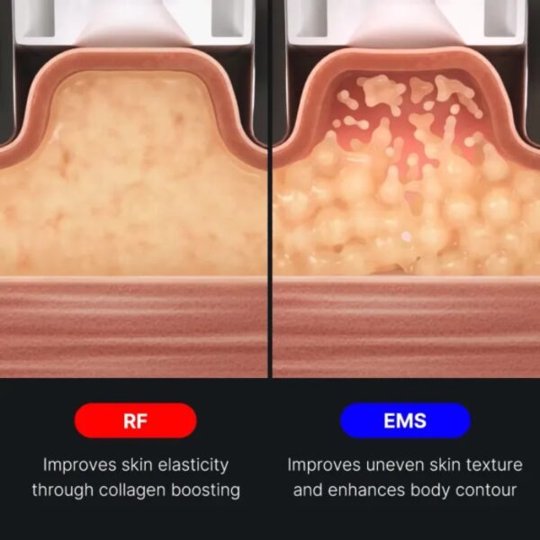 Medicube Age-R Body Shot - Image 5