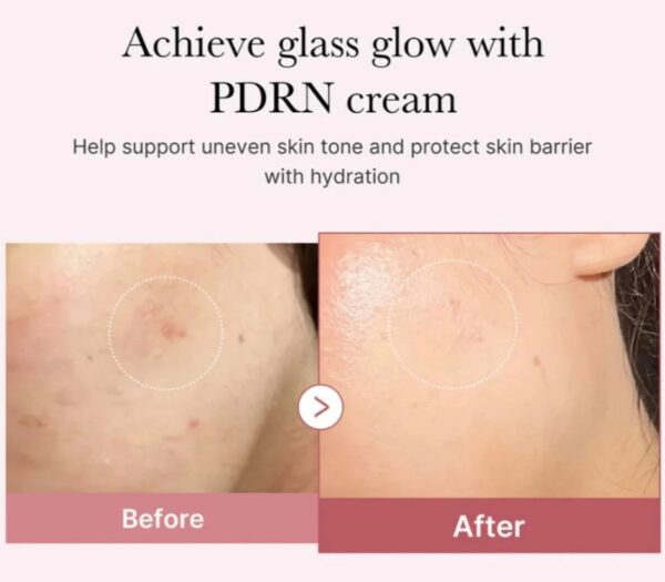 MEDICUBE PDRN Pink Hyaluronic Moisturising Cream - Image 5