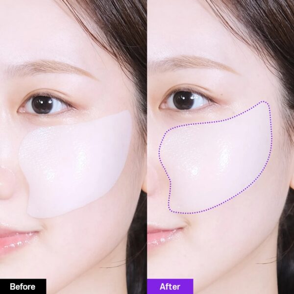 BIOHEAL BOH Probioderm 3D Lifting Voluming Patch 4+1 Set - Image 2