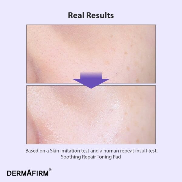 DERMAFIRM Soothing Repair Toning Pad R4 70P Set (+Refill 70P) - Image 4