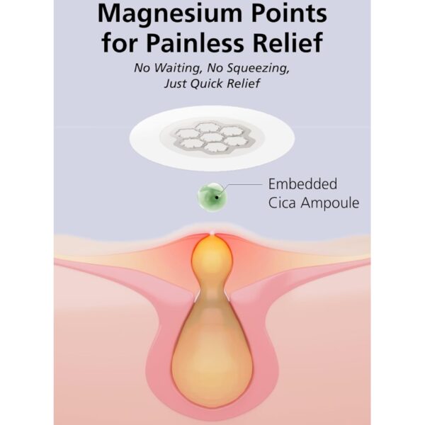 EASYDERM Beauty Needle Care Spot Patch + Cica Ampoule 10mL - Image 2