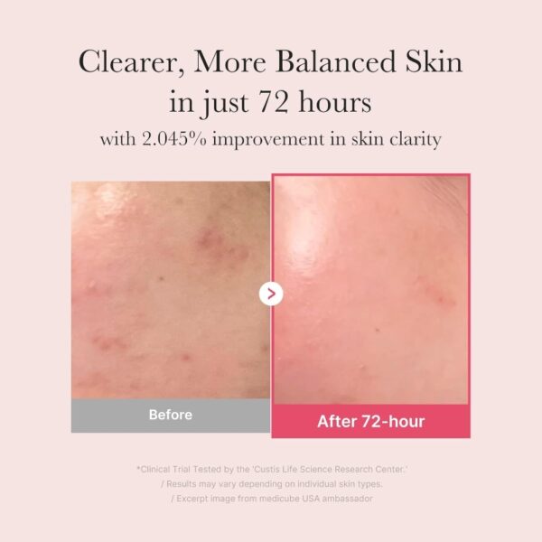 Medicube TXA Niacinamide 15 Serum - Image 3