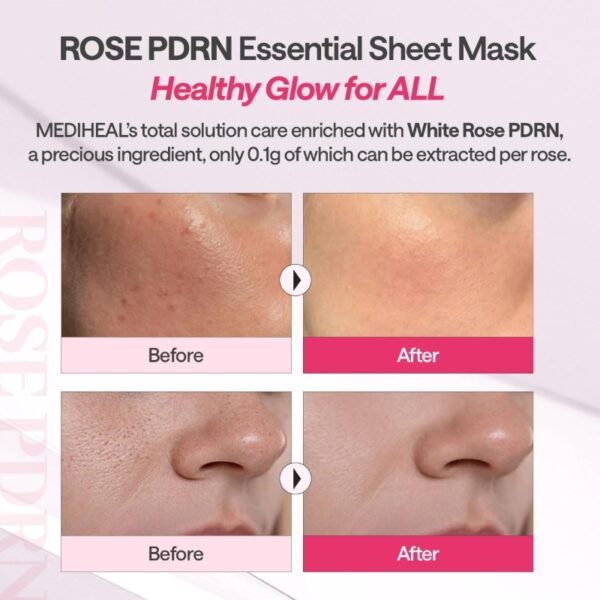 MEDIHEAL British White Rose PDRN Essential Mask Sheet Bio Emulsome [10 masks] - Image 6