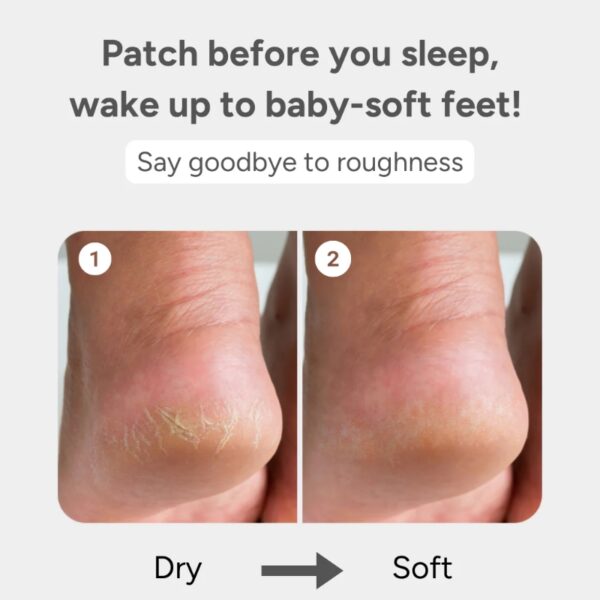 baren Shea Butter Sleeping Heel Patch (6P) - Image 2