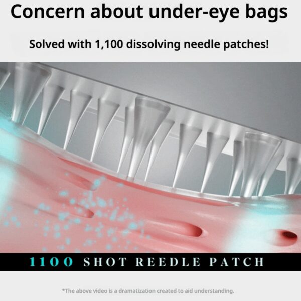 charde Eye Bag Lift 1100 Shot Reedle Patch - Image 6
