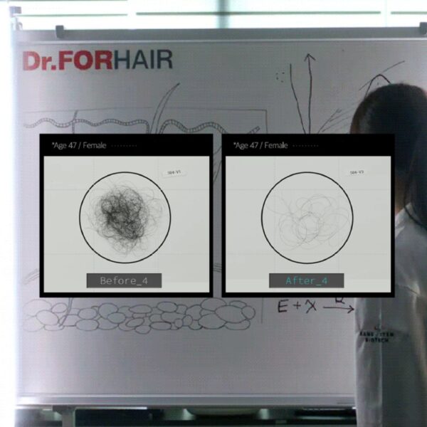 Dr.forhair Folligen Bio-3 Shampoo - Image 4