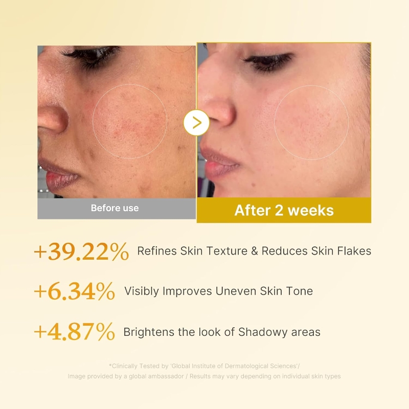 Medicube Kojic Acid Turmeric Resurfacing Toner - Image 4