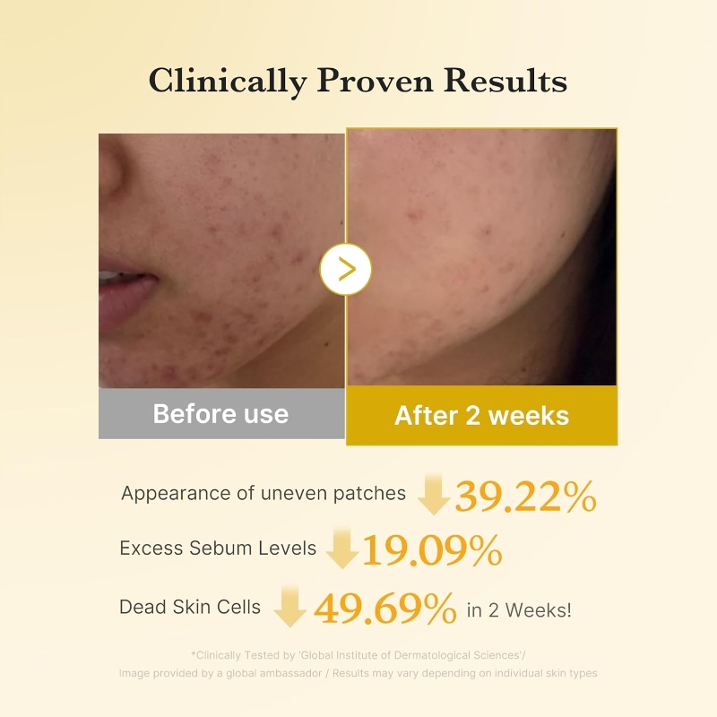 Medicube Kojic Acid Turmeric Toner Pads - Image 4