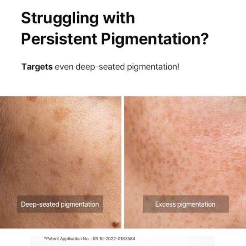 DONG-A Pharm Pigmentation Pro Cream - Image 4